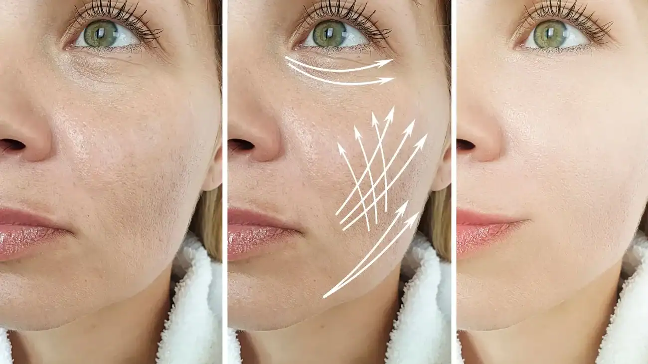 Can One Treatment Really Tackle More Than One Skin Concern Brentford?