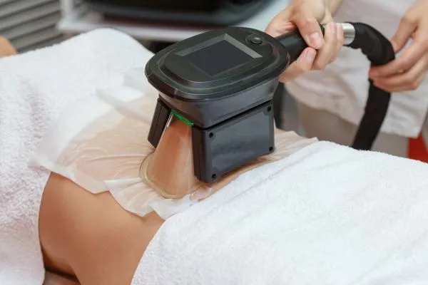 Image of person having fat freezing treatment to help weight gain Brentford