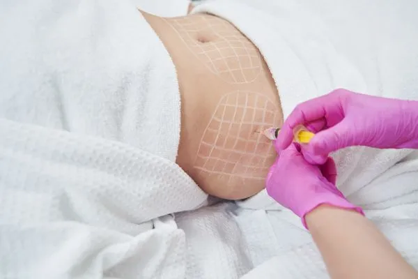 image of fat dissolving injections on love handles to help combat weight gain Brentford
