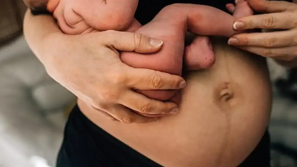 Why Is My Stomach Still Big After Pregnancy Brentford?
